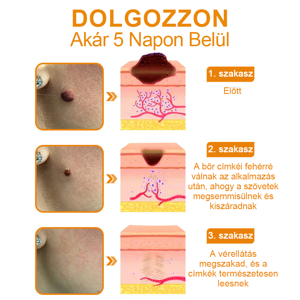 🎁🎁🎁Már csak 5 doboz maradt! További 50% kedvezményt adunk! Hozd magad formába és egészségesen. Ha most kihagyod, jövő évig nem lesz újabb esélyed.