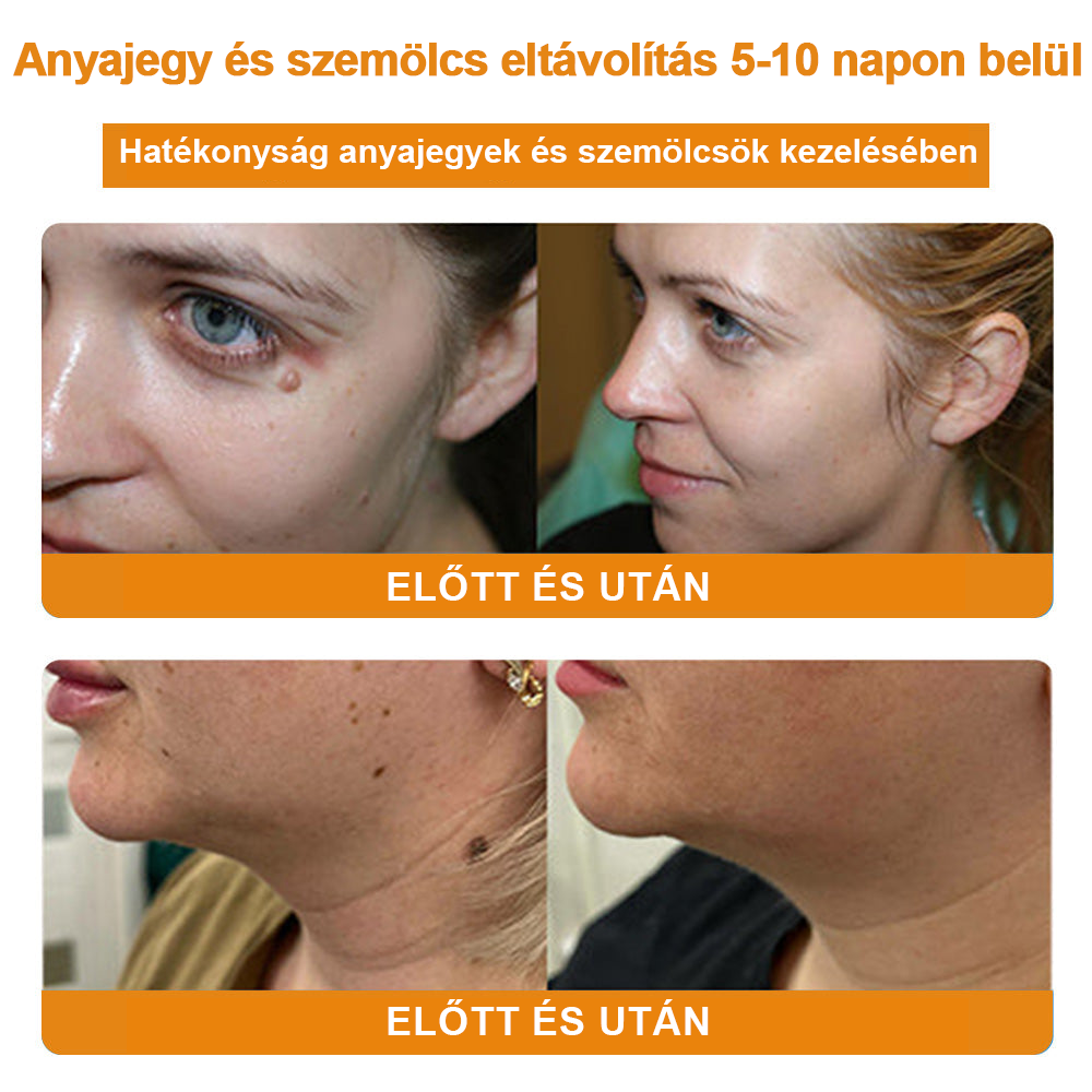 🎁🎁🎁Már csak 5 doboz maradt! További 50% kedvezményt adunk! Hozd magad formába és egészségesen. Ha most kihagyod, jövő évig nem lesz újabb esélyed.