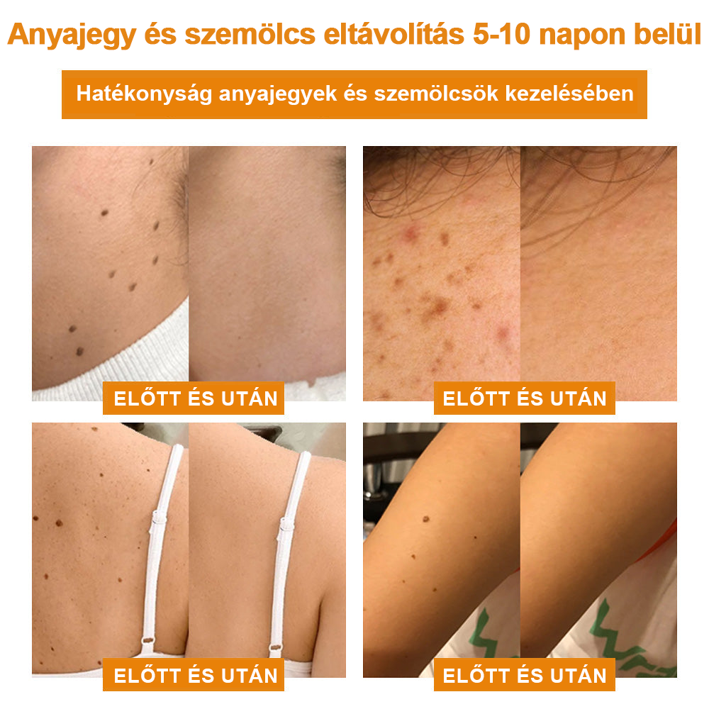 🎁🎁🎁Már csak 5 doboz maradt! További 50% kedvezményt adunk! Hozd magad formába és egészségesen. Ha most kihagyod, jövő évig nem lesz újabb esélyed.