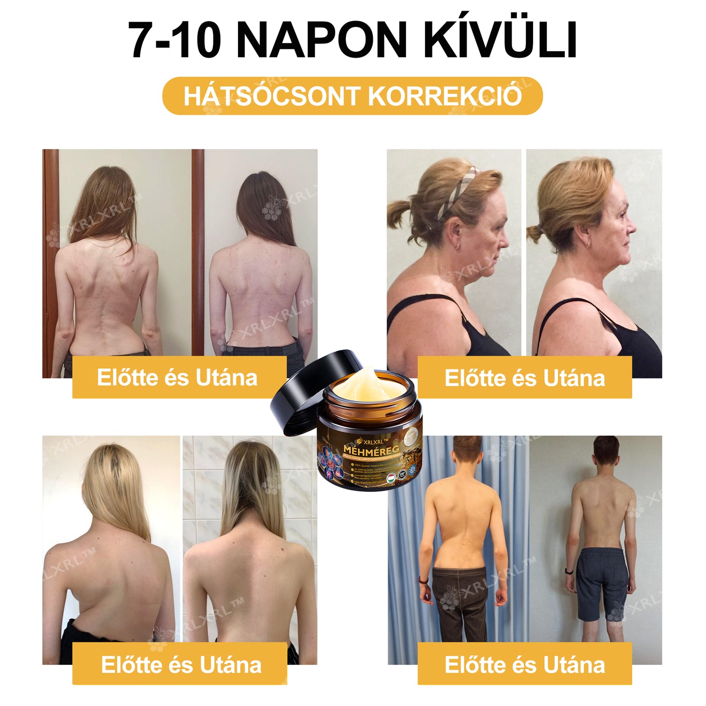 Hivatalos bolt: XRLXRL™ Méhméreg Azonnali Ultra Erős Fájdalomcsillapító Krém - (💥💥Enyhíti a fájdalmat ízületi gyulladás, izomfájdalom, hátfájás, térdek, hát, vállak, csípők, csuklók, kezek esetén) (Copy)