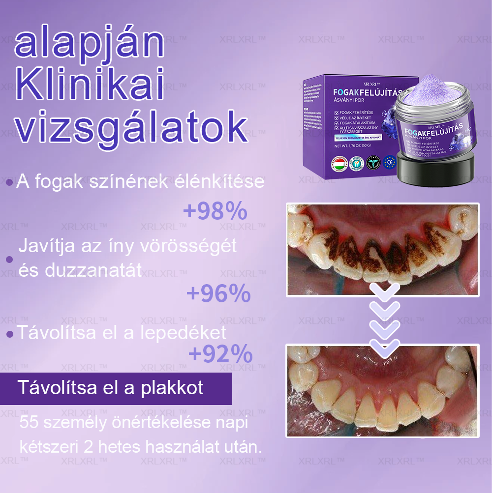 🎁Egy utolsó esély! Kapd el ezt a szerencsés leletet 70% LE!