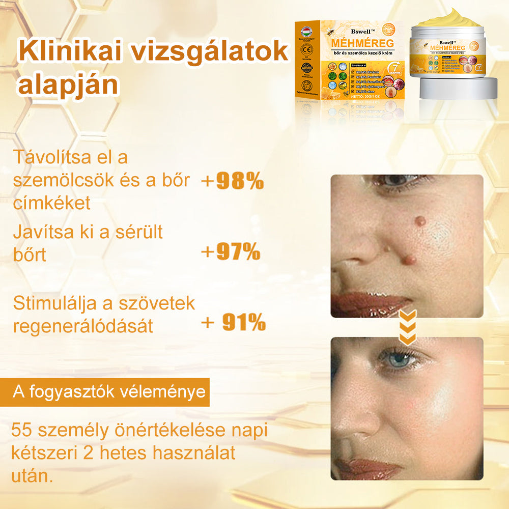 🎁🎁🎁Már csak 5 doboz maradt! További 50% kedvezményt adunk! Hozd magad formába és egészségesen. Ha most kihagyod, jövő évig nem lesz újabb esélyed.