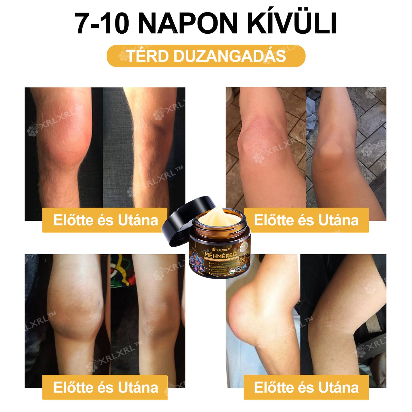 Hivatalos bolt: XRLXRL™ Méhméreg Azonnali Ultra Erős Fájdalomcsillapító Krém - (💥💥Enyhíti a fájdalmat ízületi gyulladás, izomfájdalom, hátfájás, térdek, hát, vállak, csípők, csuklók, kezek esetén) (Copy)