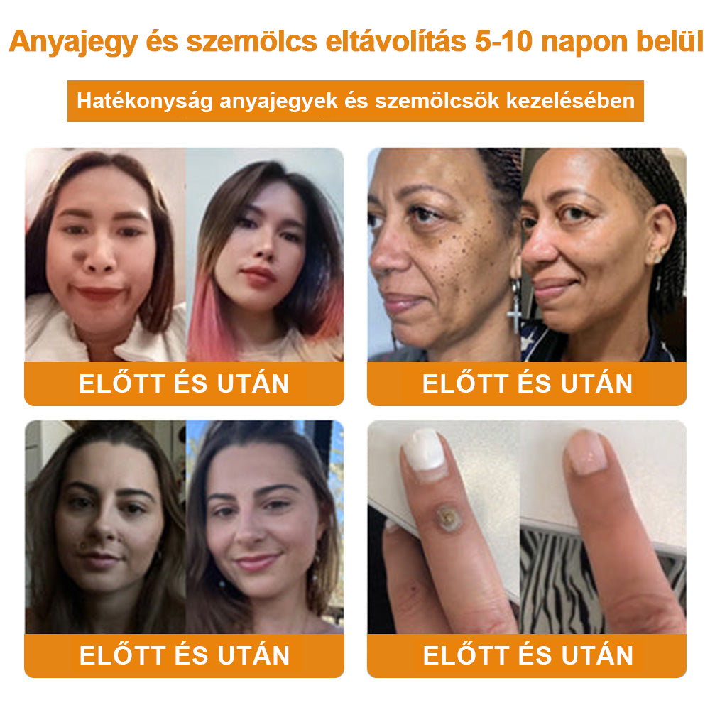 🎁🎁🎁Már csak 5 doboz maradt! További 50% kedvezményt adunk! Hozd magad formába és egészségesen. Ha most kihagyod, jövő évig nem lesz újabb esélyed.