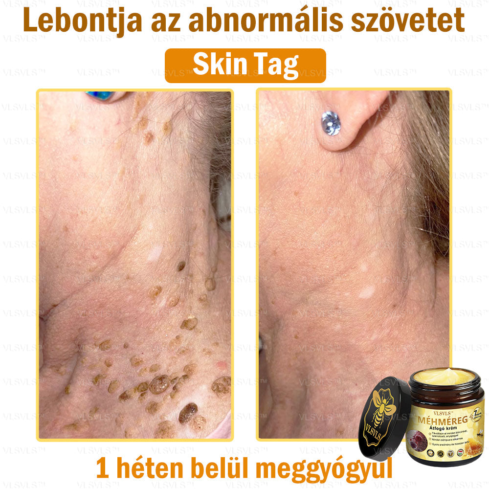 VLSVLS™ Méhméreg Átfogó Krém (Minden korosztály számára alkalmas & HSME ajánlja)