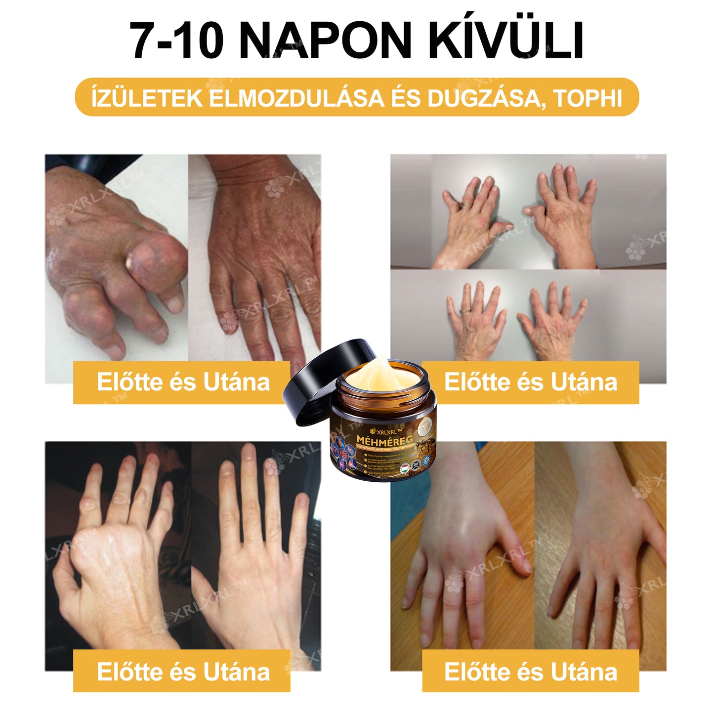 Hivatalos bolt: XRLXRL™ Méhméreg Azonnali Ultra Erős Fájdalomcsillapító Krém - (💥💥Enyhíti a fájdalmat ízületi gyulladás, izomfájdalom, hátfájás, térdek, hát, vállak, csípők, csuklók, kezek esetén) (Copy)