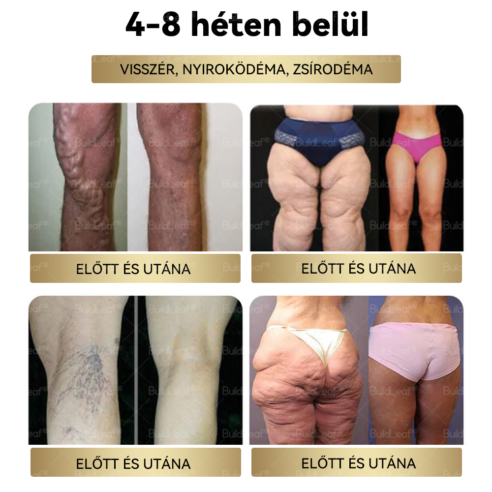 👩⚕️A Mayo Clinic által ajánlott | Hivatalos üzlet | BuildLeaf® GLP-1 Moringa Fogyókúrás és Egészségfokozó cseppek 🔥 (Élelmiszer-minőségű zsírégető – Az Obesity Society fejlesztése)