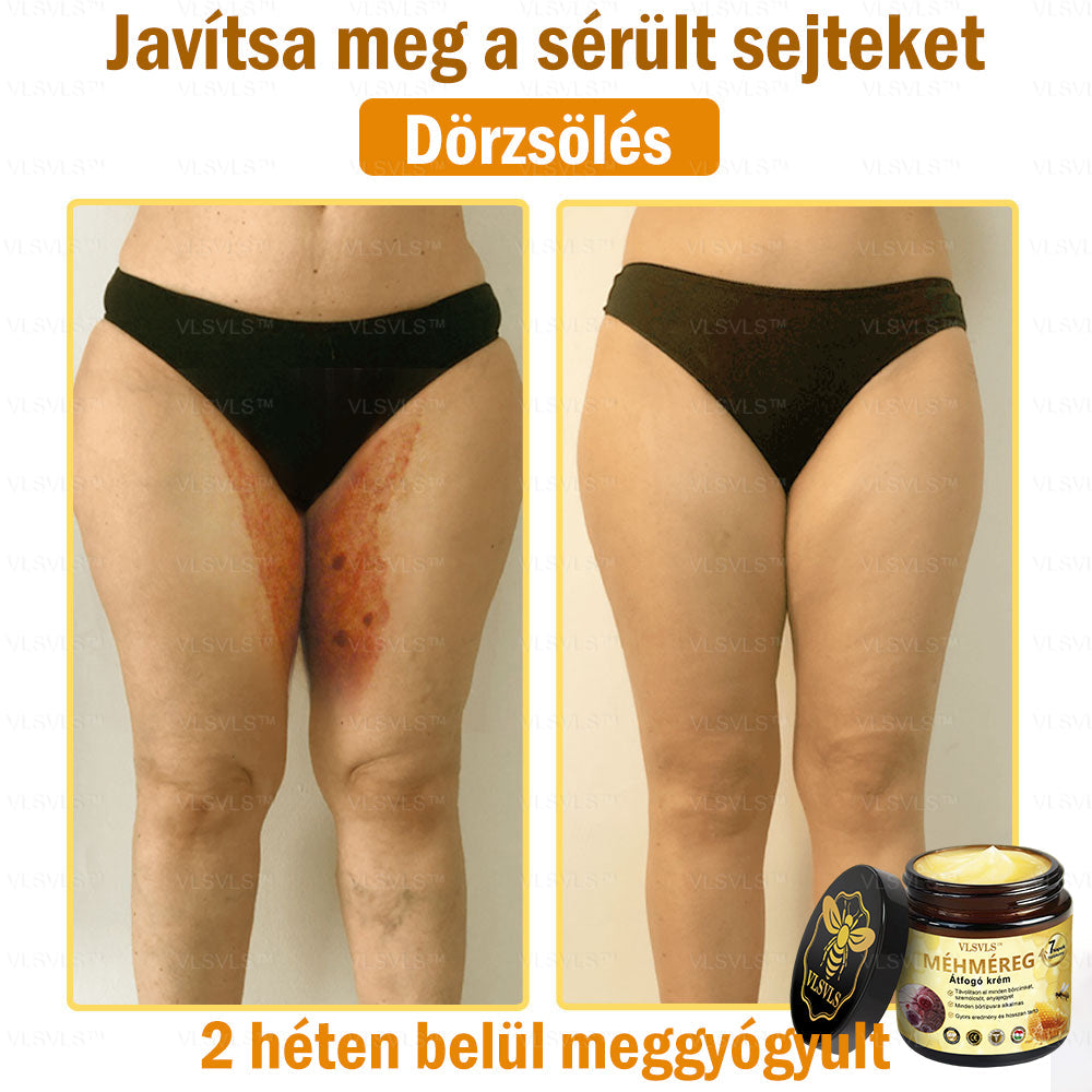 VLSVLS™ Méhméreg Átfogó Krém (Minden korosztály számára alkalmas & HSME ajánlja)