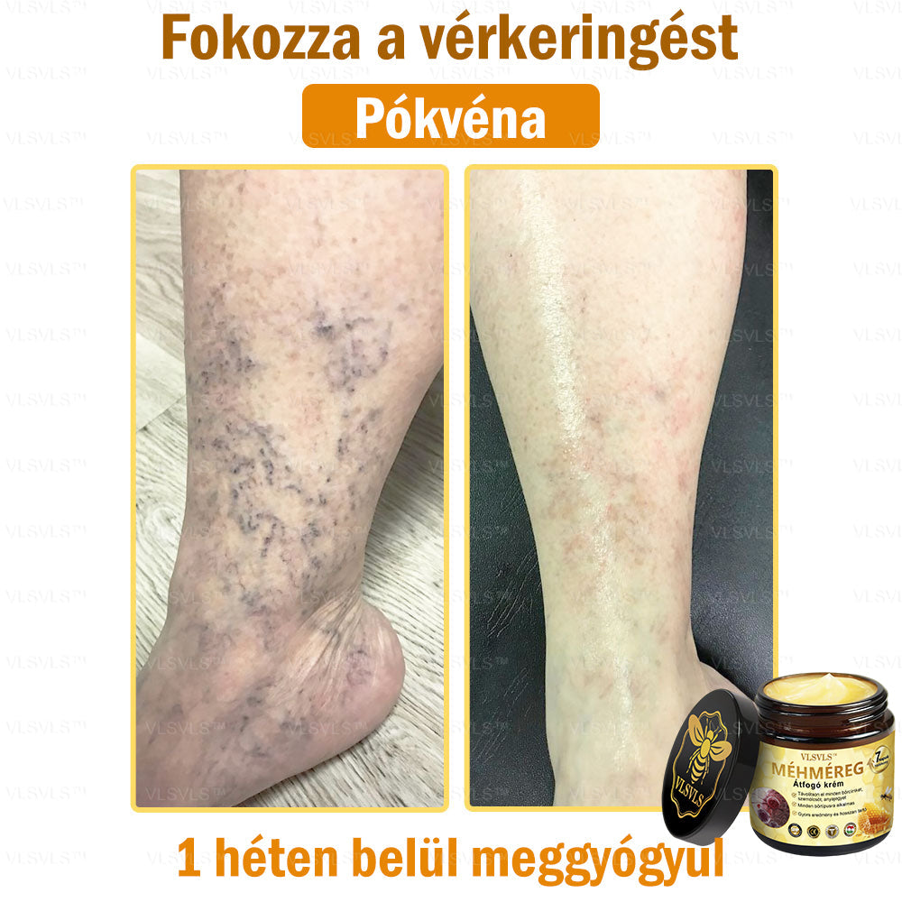 VLSVLS™ Méhméreg Átfogó Krém (Minden korosztály számára alkalmas & HSME ajánlja)