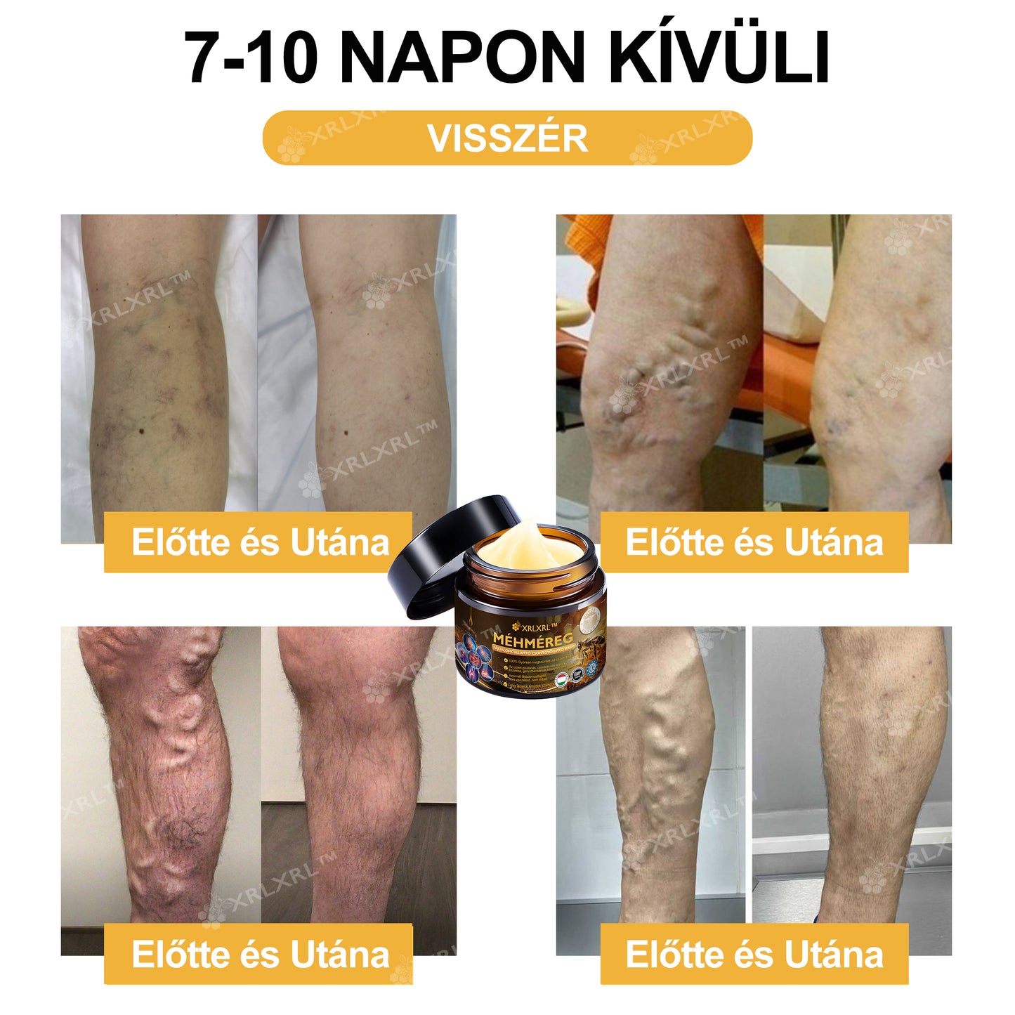 Hivatalos bolt: XRLXRL™ Méhméreg Azonnali Ultra Erős Fájdalomcsillapító Krém - (💥💥Enyhíti a fájdalmat ízületi gyulladás, izomfájdalom, hátfájás, térdek, hát, vállak, csípők, csuklók, kezek esetén) (Copy)