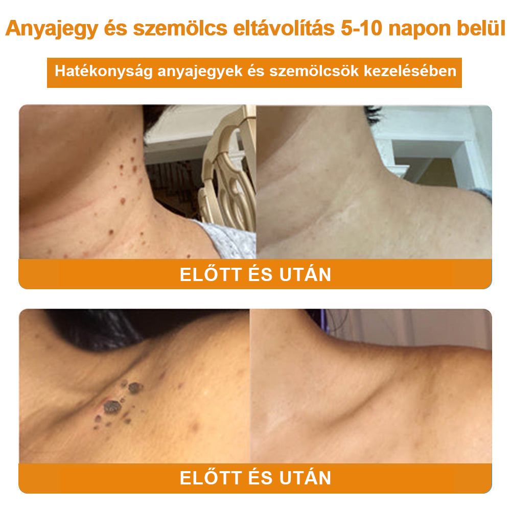 🎁🎁🎁Már csak 5 doboz maradt! További 50% kedvezményt adunk! Hozd magad formába és egészségesen. Ha most kihagyod, jövő évig nem lesz újabb esélyed.