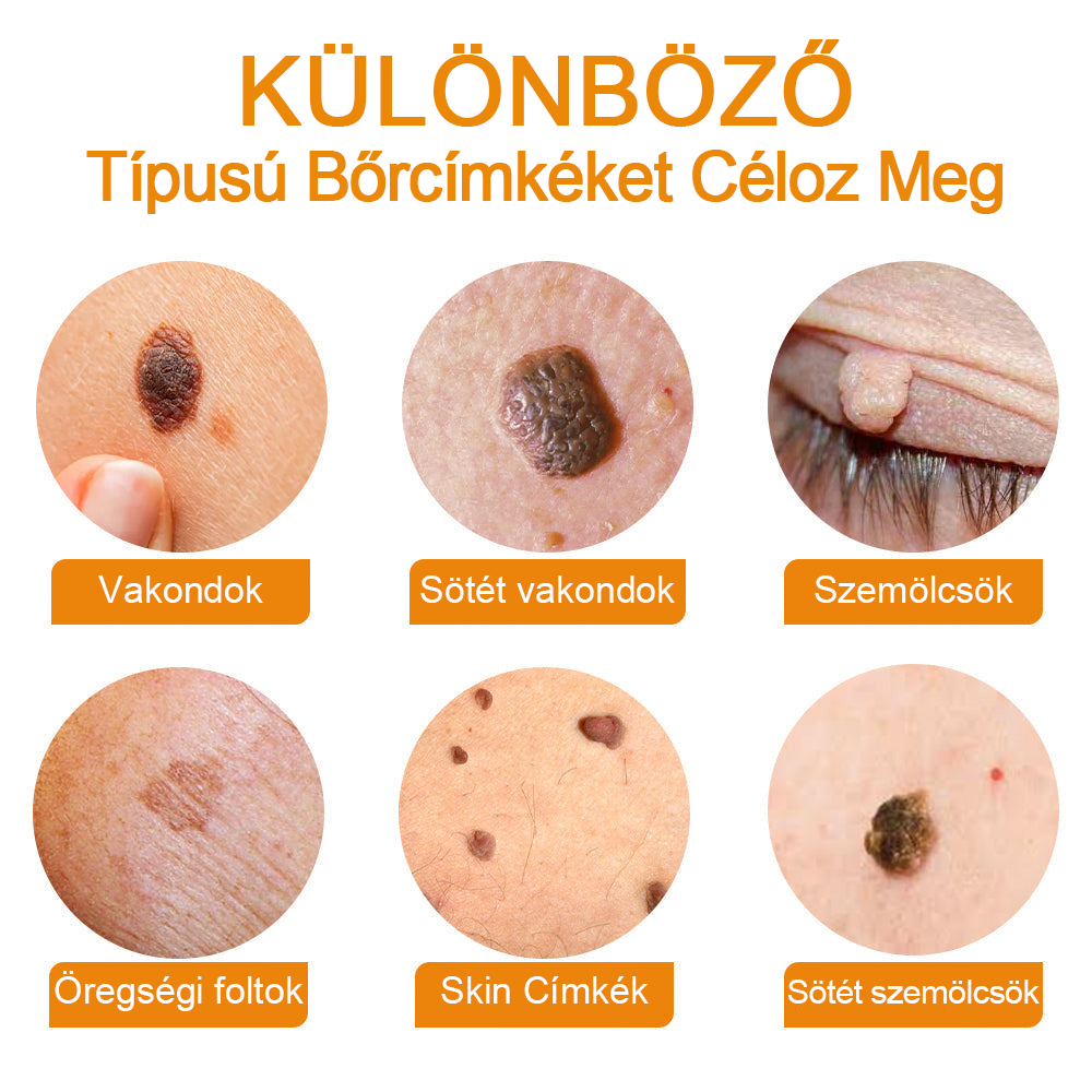 🎁🎁🎁Már csak 5 doboz maradt! További 50% kedvezményt adunk! Hozd magad formába és egészségesen. Ha most kihagyod, jövő évig nem lesz újabb esélyed.