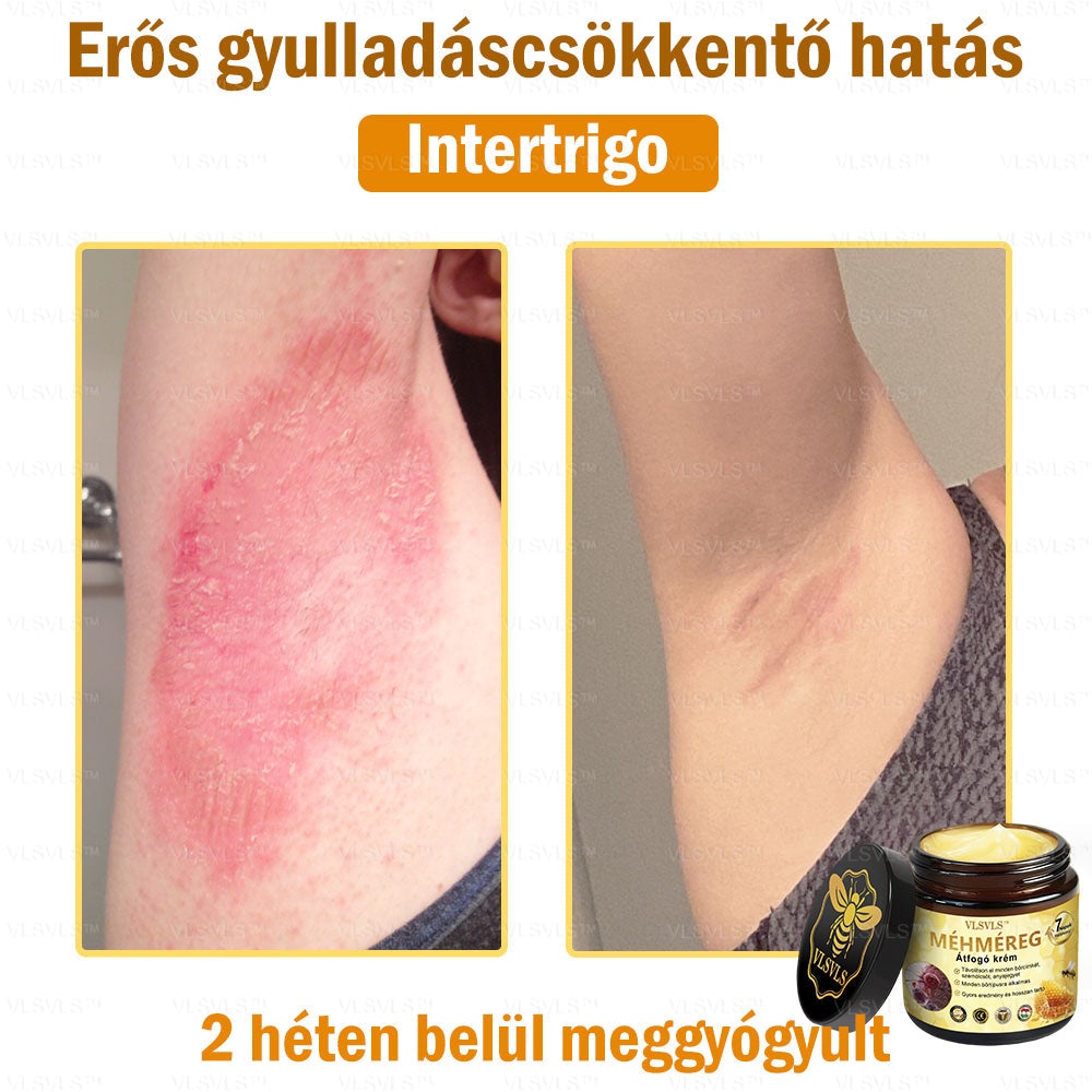 VLSVLS™ Méhméreg Átfogó Krém (Minden korosztály számára alkalmas & HSME ajánlja)