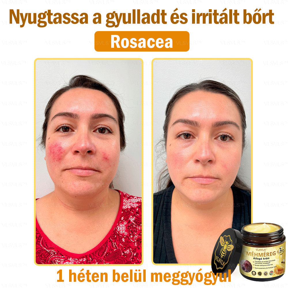 VLSVLS™ Méhméreg Átfogó Krém (Minden korosztály számára alkalmas & HSME ajánlja)