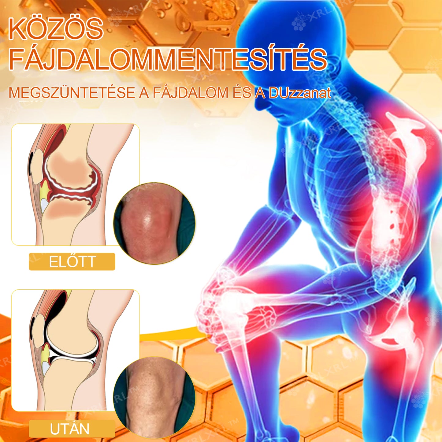 Hivatalos bolt: XRLXRL™ Méhméreg Azonnali Ultra Erős Fájdalomcsillapító Krém - (💥💥Enyhíti a fájdalmat ízületi gyulladás, izomfájdalom, hátfájás, térdek, hát, vállak, csípők, csuklók, kezek esetén) (Copy)