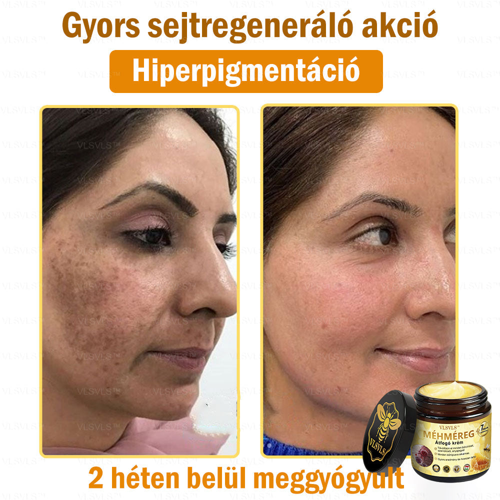 VLSVLS™ Méhméreg Átfogó Krém (Minden korosztály számára alkalmas & HSME ajánlja)